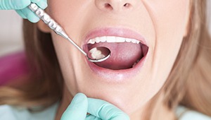 Closeup of patient receiving dental examination